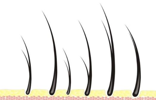 女性剃掉陰毛好嗎？女人私處陰毛多正常嗎？女人私處體毛有什么作用